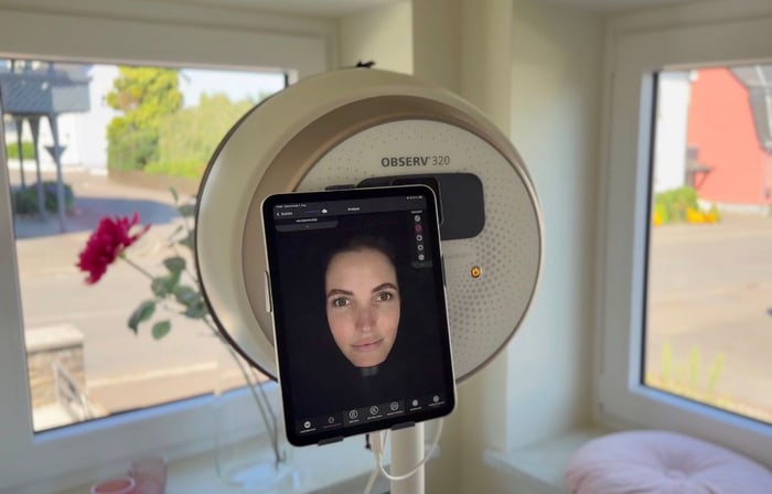 OBSERV 320 Hautanalysegerät