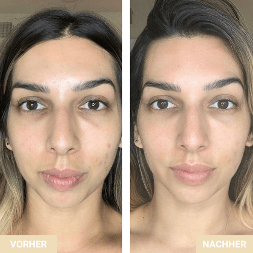 Vorher/Nachher – Ebenmäßigkeit